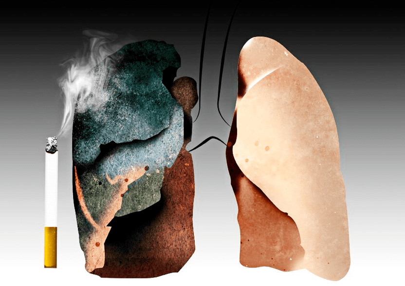 What does smoking lead to 